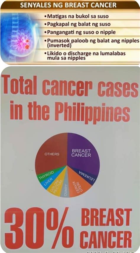 Bukol sa Dibdib: Breast Cancer at Mga Uri Ng Bukol Na Hindi .